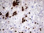 S100A9 Antibody in Immunohistochemistry (Paraffin) (IHC (P))