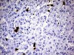 S100A9 Antibody in Immunohistochemistry (Paraffin) (IHC (P))