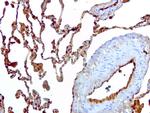 S100A9 Antibody in Immunohistochemistry (Paraffin) (IHC (P))