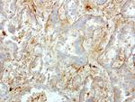 S100A9 Antibody in Immunohistochemistry (Paraffin) (IHC (P))