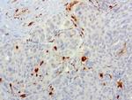 S100A9 Antibody in Immunohistochemistry (Paraffin) (IHC (P))