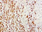 S100A9 Antibody in Immunohistochemistry (Paraffin) (IHC (P))