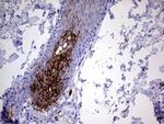 S100A9 Antibody in Immunohistochemistry (Paraffin) (IHC (P))