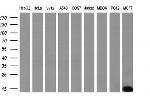 S100A9 Antibody in Western Blot (WB)