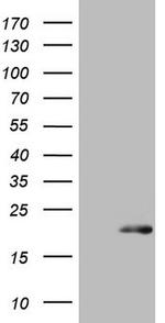 S100A9 Antibody in Western Blot (WB)