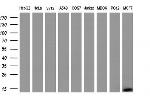 S100A9 Antibody in Western Blot (WB)