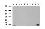 S100A9 Antibody in Western Blot (WB)