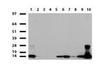 S100A9 Antibody in Western Blot (WB)