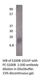 S100 beta Antibody in Western Blot (WB)