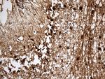 S100B Antibody in Immunohistochemistry (Paraffin) (IHC (P))