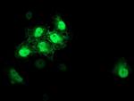 S100P Antibody in Immunocytochemistry (ICC/IF)