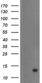 S100P Antibody in Western Blot (WB)