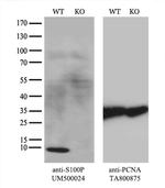 S100P Antibody in Western Blot (WB)