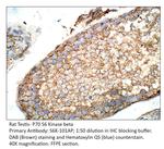 P70 S6 Kinase beta Antibody in Immunohistochemistry (IHC)