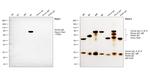 Human IgE Secondary Antibody in Western Blot (WB)