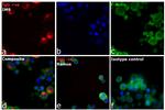 Human IgG (H+L) Cross-Adsorbed Secondary Antibody in Immunocytochemistry (ICC/IF)