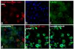 Human IgG Fc Cross-Adsorbed Secondary Antibody in Immunocytochemistry (ICC/IF)