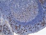 Human IgA1 Secondary Antibody in Immunohistochemistry (IHC)