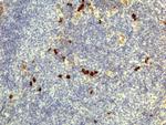 Human IgD Secondary Antibody in Immunohistochemistry (IHC)