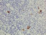 Human IgG3 Secondary Antibody in Immunohistochemistry (IHC)