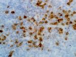 Human Kappa Light Chain Secondary Antibody in Immunohistochemistry (IHC)