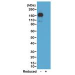 Mouse IgA Secondary Antibody in Western Blot (WB)