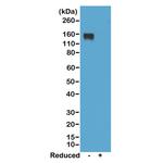 Mouse IgG2a Secondary Antibody in Western Blot (WB)