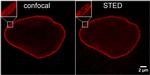 Rabbit IgG Nano (VHH) Secondary Antibody in Immunocytochemistry (ICC/IF)