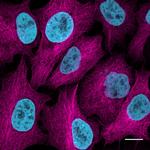 Rabbit IgG Nano (VHH) Secondary Antibody in Immunocytochemistry (ICC/IF)