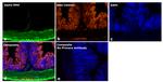 Mouse IgG2a Secondary Antibody in Immunohistochemistry (Paraffin) (IHC (P))