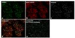 Mouse IgG2a Secondary Antibody in Immunohistochemistry (Paraffin) (IHC (P))