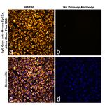 Mouse IgG2a Secondary Antibody in Immunocytochemistry (ICC/IF)