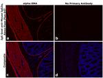 Mouse IgG2a Secondary Antibody in Immunohistochemistry (Paraffin) (IHC (P))