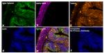 Mouse IgG2a Secondary Antibody in Immunohistochemistry (Paraffin) (IHC (P))