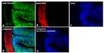 Mouse IgG2a Secondary Antibody in Immunohistochemistry (Paraffin) (IHC (P))