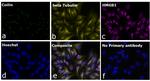 Mouse IgG2a Secondary Antibody in Immunocytochemistry (ICC/IF)