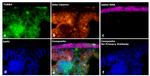 Mouse IgG2a Secondary Antibody in Immunohistochemistry (Paraffin) (IHC (P))