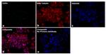 Mouse IgG2b Secondary Antibody in Immunocytochemistry (ICC/IF)