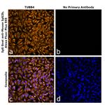 Mouse IgG2b Secondary Antibody in Immunocytochemistry (ICC/IF)