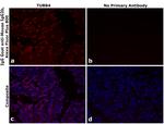 Mouse IgG2b Secondary Antibody in Immunohistochemistry (Paraffin) (IHC (P))