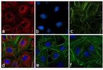 Rat IgG (H+L) Cross-Adsorbed Secondary Antibody in Immunocytochemistry (ICC/IF)