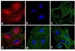 Rat IgG (H+L) Cross-Adsorbed Secondary Antibody in Immunocytochemistry (ICC/IF)