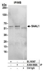 SAAL1 Antibody in Western Blot (WB)