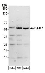 SAAL1 Antibody in Western Blot (WB)