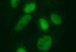 SAE1 Antibody in Immunocytochemistry (ICC/IF)