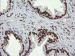 SAE1 Antibody in Immunohistochemistry (Paraffin) (IHC (P))