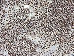 SAE1 Antibody in Immunohistochemistry (Paraffin) (IHC (P))