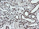 SAE1 Antibody in Immunohistochemistry (Paraffin) (IHC (P))