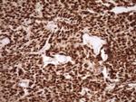 SAE1 Antibody in Immunohistochemistry (Paraffin) (IHC (P))