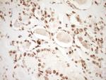 SAE1 Antibody in Immunohistochemistry (Paraffin) (IHC (P))